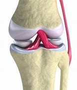 Image result for Knee Bones and Joints