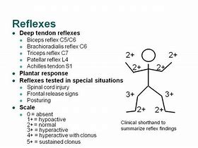 Image result for Reflexes 2