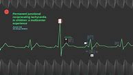 Image result for Permanent Junction Al Reciprocating Tachycardia