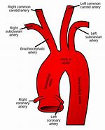 Image result for Aortic Vessels