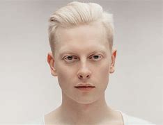 Image result for White Albino Africans