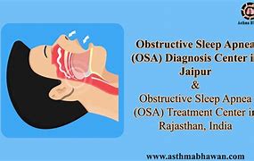 Image result for Osa Sleep Apnea