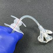 Image result for PEG Tube Replacement