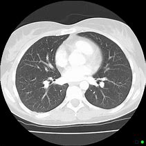 Image result for CT Scan Views