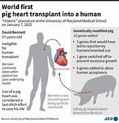 Image result for Pig Heart Transplant