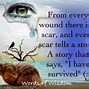 Image result for SA Survivor Quotes