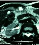 Image result for IRM Abdominal