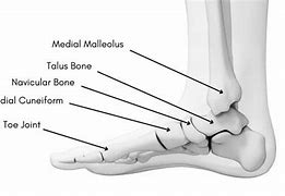 Image result for Area Distal to Lateral Malleolus