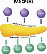 Image result for Pancreatic Adenocarcinoma