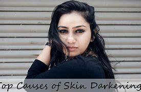 Image result for Skin Darkening