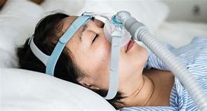 Image result for Obstructive Sleep Apnea Machine