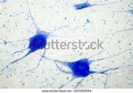 Image result for Brain Tissue Histology