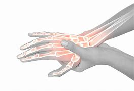 Image result for Pain in Wrist below Thumb