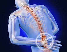 Image result for Lumbosacral Fusion