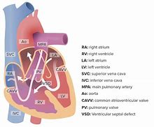 Image result for Atrioventricular Septum