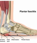 Image result for Plantar Bottom of Foot