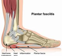 Image result for Thug Plantar