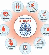 Image result for Stroke Cure