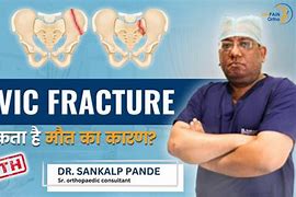 Image result for Fracture Exterior