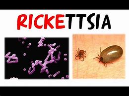 Image result for Rickettsia