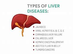 Image result for Liver Ptosis