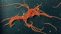 These worm blobs can untangle themselves in milliseconds – and scientists think that can help them develop better robots. More about the science of worms: https://www.bbc.co.uk/sounds/play/w3cszv5w | BBC World Service