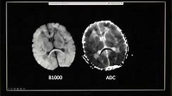 Pediatric Head Ultrasounds