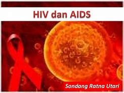 Image result for HIV Dan Aids