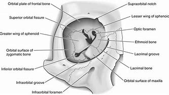 Image result for Orbital Rim Bones