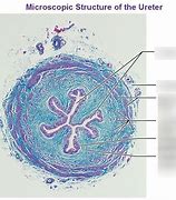 Image result for Ureter Histology Slides Labeled