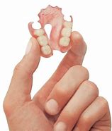 Image result for Valplast Partial One Tooth