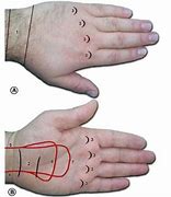 Image result for Volar and Dorsal Hand