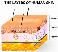 Image result for Dermis Skin Cut