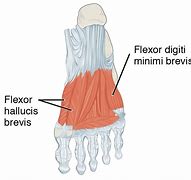 Image result for M Flexor Digiti Minimi Brevis