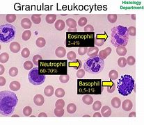 Image result for Thrombosis Histology