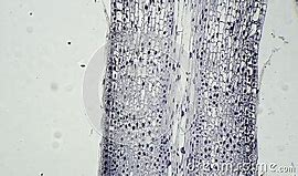 Image result for Allium Root Tip Labeled