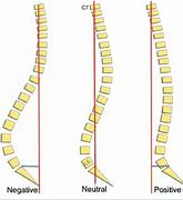 Image result for Plumb Line On Human Body