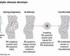 Image result for RH Blood Group System