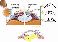 Image result for Narrow Inset Eyes