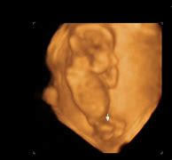 Image result for 4D Ultrasound at 15 Weeks