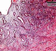 Image result for Uterus Layers Histology