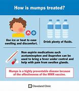 Image result for Mumps Child