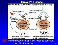 Image result for TSH Receptor Antibodies