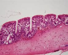 Image result for Ciliated Epithelium Cell