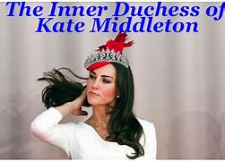 Image result for British Royal Family Hair Loss