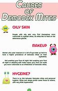 Image result for Kill Demodex Mites On Humans