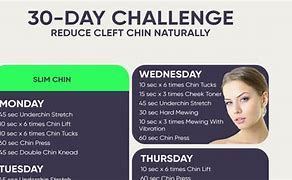 Image result for What Is Cleft Chin