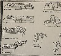 Image result for Dorsal Recumbent Position