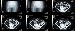 Image result for IRM Abdominale