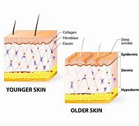 Image result for Dermis Skin Cut